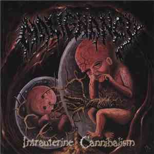Malignancy - Intrauterine Cannibalism download free